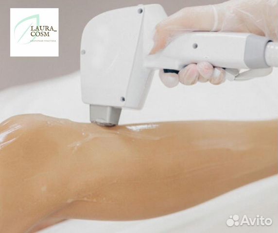 Лазерная эпиляция Лазерная эпиляция